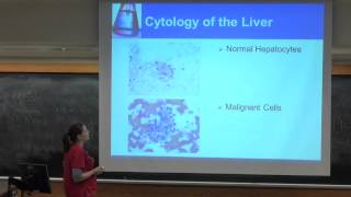 Careers in MCB Cytotechnology Pt 1 [upl. by Dowski]