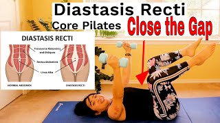 Diastasis Recti Core and Abdominal Strengthening Pilates Program with Dumbbells Progression [upl. by Hathcock]