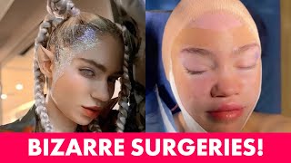 10 Most Bizarre Plastic Surgeries You Wont Believe Are Real [upl. by Humfrey973]