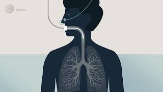 Bronchoscopy  examination of your airways English version [upl. by Laurin]