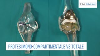 Protesi di ginocchio monocompartimentale vs totale [upl. by Tolman]