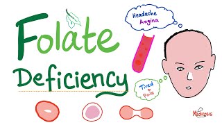 Folate deficiency  Megaloblastic Anemia  Macrocytic  Hematology Series [upl. by Nail359]