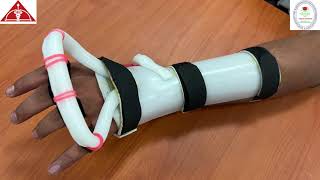 Fabrication Of Customized Radial Nerve Palsy Splint Video  Dept Of Occupational Therapy  SRMC [upl. by Nyraa]