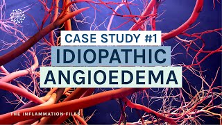 Idiopathic Angioedema  Case Study 1 The Inflammation Files with Dr Kara Wada [upl. by Eisse]