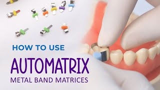 How to use Automatrix Metal Band Matrices [upl. by Adley]