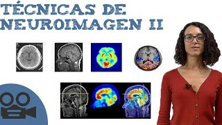 Técnicas de neuroimagen II [upl. by Rosalie]