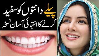 My Secret to go from Yellow to White Teeth  Rabi Pirzada [upl. by Meier605]