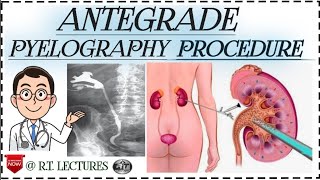 Antegrade pyelogram Antegrade pyelography procedure Alternate of IVP procedure in hindienglish [upl. by Juanita]