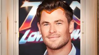 Chris Hemsworths Hairline The Evolution Hair Transplant [upl. by Auhsohey]