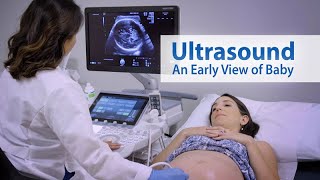 ULTRASOUND An Early View of Baby [upl. by Farhsa]