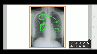 Practical medicine Xray Practice  3 [upl. by Mauchi]