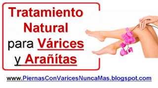 Tratamiento Natural Para Curar Las Varices y Arañitas en las Piernas  Varices Tratamiento Natural [upl. by Nosreh]