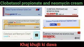 Clobetasol propionate and neomycin sulphate cream in hindi  daad khaj khujli ki dawa [upl. by Guild545]