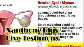 Ovarian Cyst MyomaXANTHONE PLUS Live Testimony [upl. by Htir693]