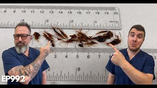 INSANE Amount Of Hair Removed From My Ear Canal  EP992 [upl. by Tabbatha]