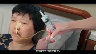 3 Performing Nasogastric Tube NGT Feeding [upl. by Collete]