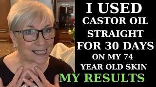 I USED CASTOR OIL FOR 30 DAYS ON MY 74YEAROLD SKIN  MY RESULTS [upl. by Idnac]