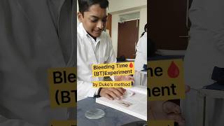 Bleeding time experiment  MBBS lifeyoutubeshorts neetmotivation neet2024 [upl. by Jerol481]