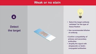 Immunohistochemistry Tips and Tricks for Weak or No Stain [upl. by Annairt]