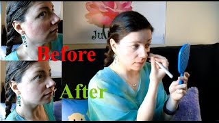 How to Cover Rosacea with Drugstore Makeup and No Skill  Rosy JulieBC [upl. by Zebulon]