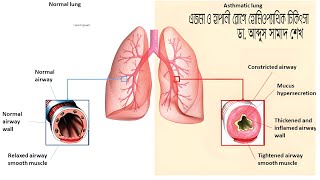 homoeohospital lerningforeveryoneএজমা [upl. by Farica]