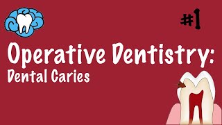 Operative Dentistry  Dental Caries  INBDE ADAT [upl. by Heydon]