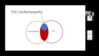 PVCs When Should We Worry [upl. by Eillam]