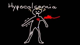 Hypocalcemia [upl. by Briana]