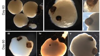 Brain organoid news roundup [upl. by Romola961]