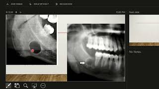 Lecture 2 Lesion Characteristics and Description [upl. by Nollid]