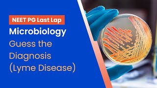 NEETPG Prep  Microbiology  Guess the Disease Lyme Disease by Dr Meenakshi Sundaram [upl. by Ycniuqed]