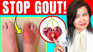 Do These 3 Things To Ease Gout at Home [upl. by Carole30]