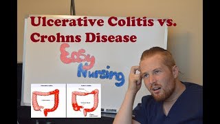 Ulcerative Colitis vs Crohns Disease  NCLEX Review [upl. by Ahsain82]