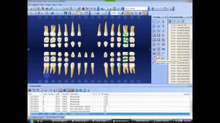 new pt in dentrix chart [upl. by Nyleuqcaj]