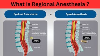 Regional anesthesia lacture Classification Neuraxial Blocks Peripheral Nerve Blocks Toxic Effect [upl. by Tiram]