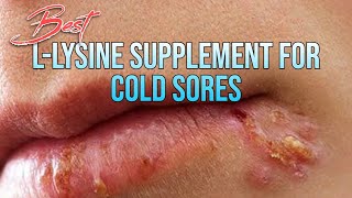 The Best 03 LLysine Supplements For Cold Sores Treatment uses and More [upl. by Damek239]