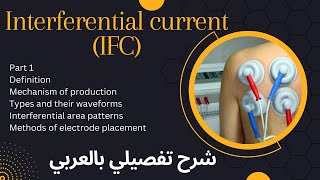 Interferential current IFCشرح تفصيلي بالعربي [upl. by Australia]