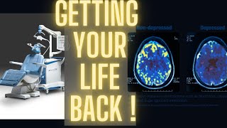 Transcranial Magnetic Stimulation  How it treats depression and first day expectations [upl. by Einehpets]