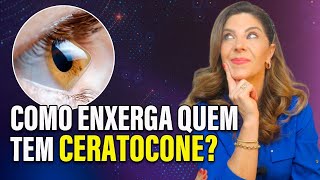 Como Enxerga Quem Tem Ceratocone [upl. by Oinolopa]