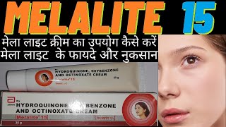 melalite cream use in hindi मेला लाइट क्रीम का उपयोग कैसे करें how to use melalite 15 side amp effects [upl. by Eisler]