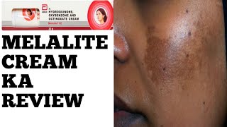 Melalite Cream Review in Hindi [upl. by Adnih]