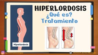 ✅Lordosis e HIPERLORDOSIS LUMBAR y CERVICAL ejercicios [upl. by Aeslahc]