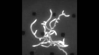 A mechanism for FtsZindependent proliferation in Streptomyces [upl. by Rodoeht]