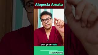 Unlocking Alopecia Areata Dr Vikram’s Expert Secrets  Neograft Chandigarh alopeciaareata [upl. by Akemor]