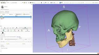 3D Slicer TutorialSkull [upl. by Hoban]