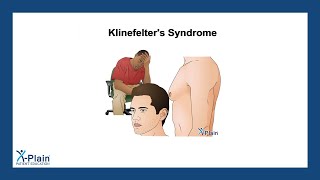 Klinefelters Syndrome [upl. by Tartan]