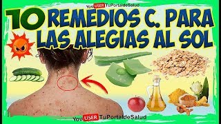 10 Remedios Para Alergias del SolREMEDIOS CASEROS PARA LAS ALERGIAS EN LA PIEL [upl. by Haida180]