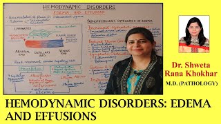 EDEMA AND EFFUSIONS  Pathophysiologic categories of edema  HEMODYNAMIC DISORDERS [upl. by Enidlareg]