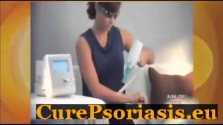 Vitamin C For Psoriasis [upl. by Alicia]