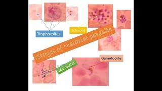 Malarial parasites identification within two minutes  Trophozoite Schizont Gametocyte Merozoite [upl. by Berger]